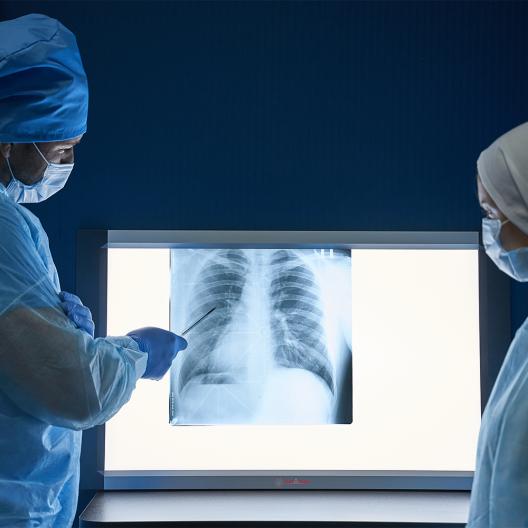 Негатоскоп Армед 2-кадровый 4