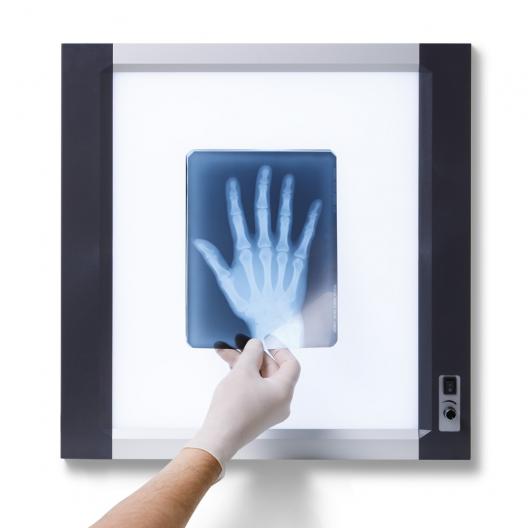 Негатоскоп Армед 1-кадровый 7