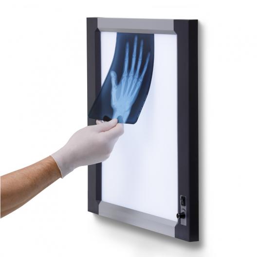 Негатоскоп Армед 1-кадровый 8