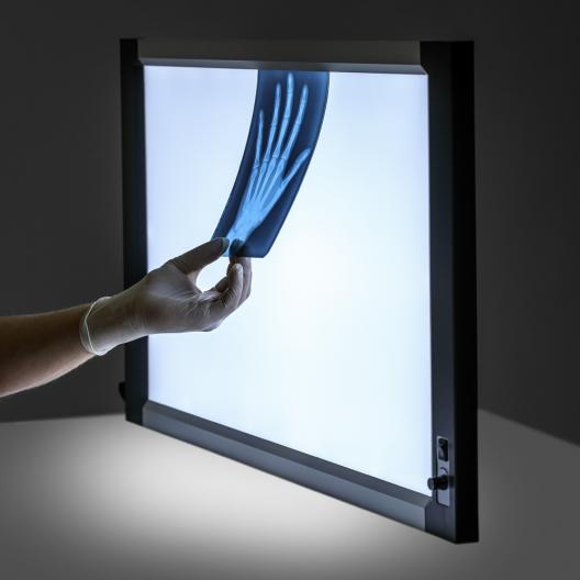 Негатоскоп Армед 2-кадровый 8