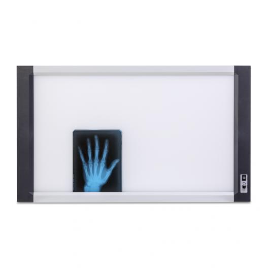 Негатоскоп Армед 2-кадровый 6