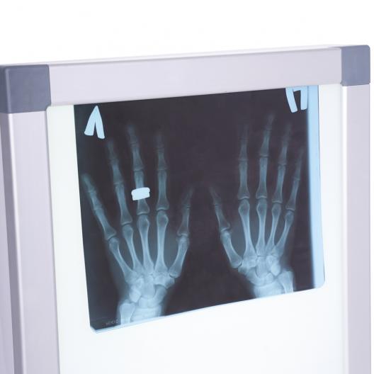 НЕГАТОСКОП общего назначения  Армед  19