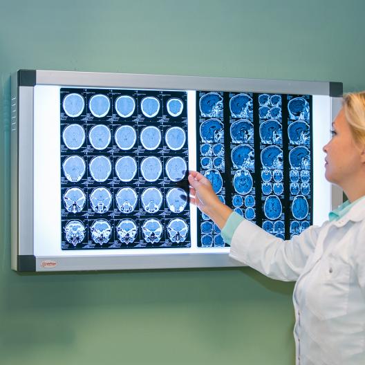 НЕГАТОСКОП общего назначения "Armed" 2-кадровый (новинка) Армед  2